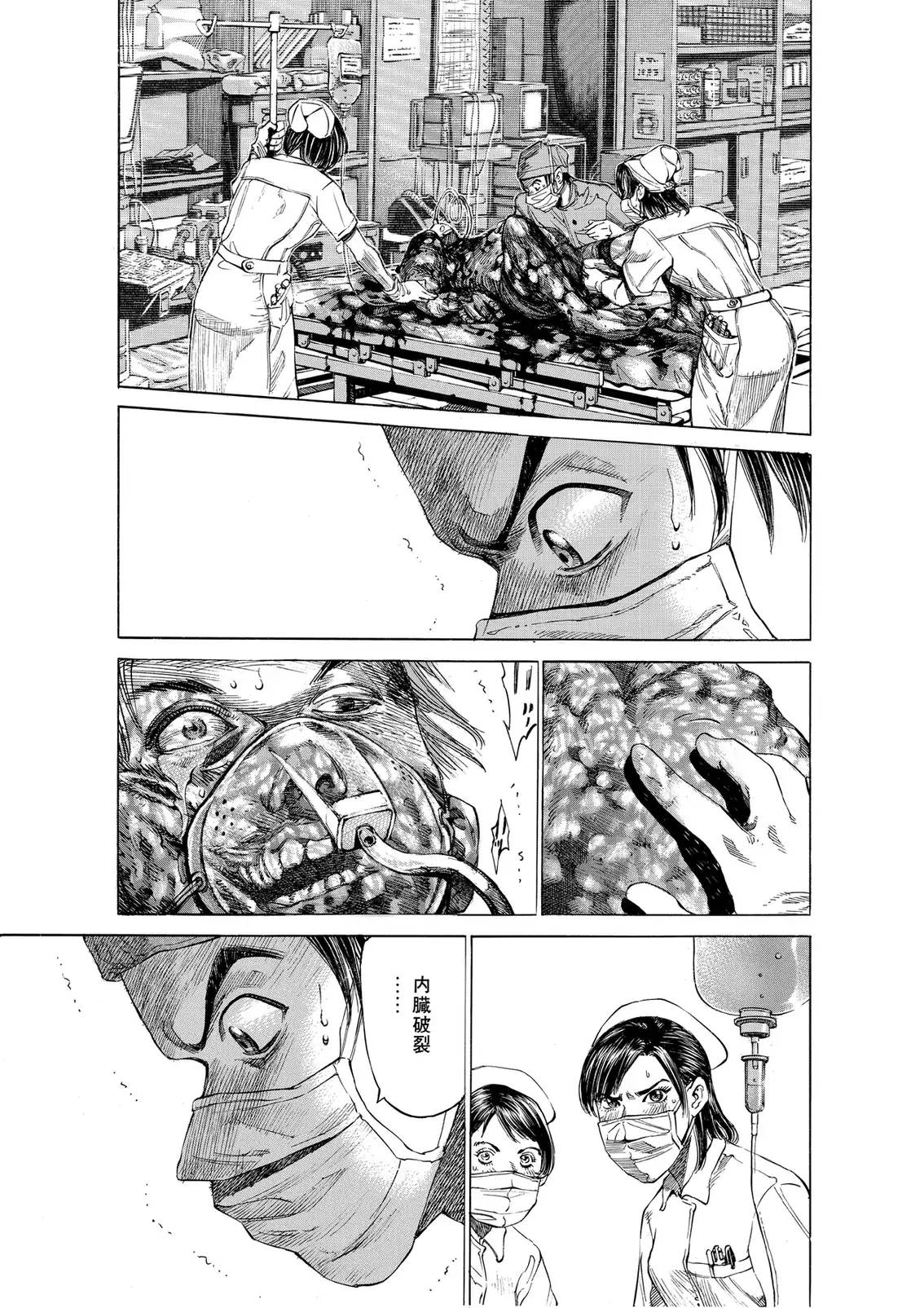 Blackjack ni Yoroshiku, Japanese-language page 43.